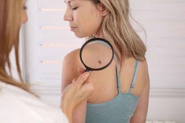 What Are Traditional Skin Lesion Removal Methods East Kilbride?