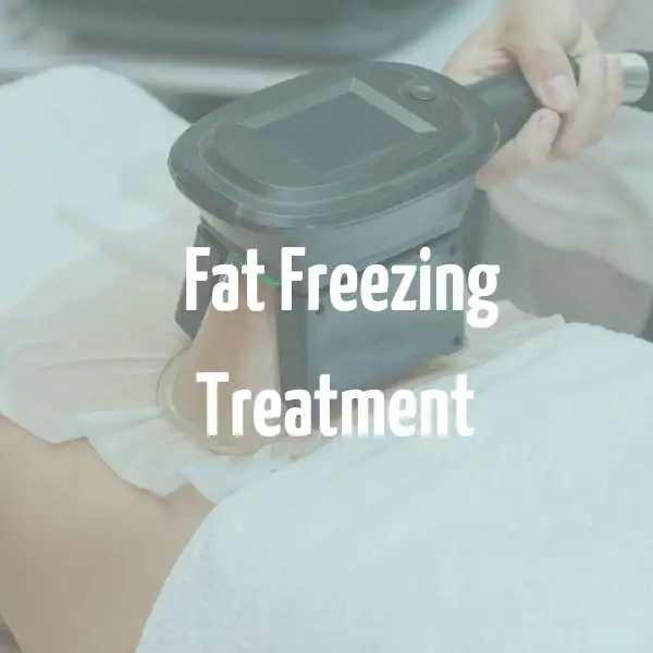 fat freezing treatment East Kilbride