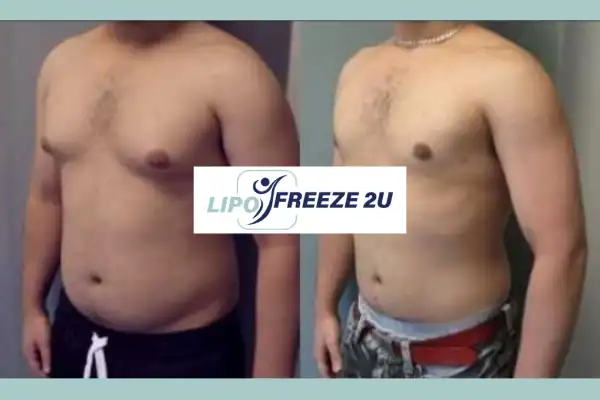 How Long Does It Take to See Results East Kilbride?