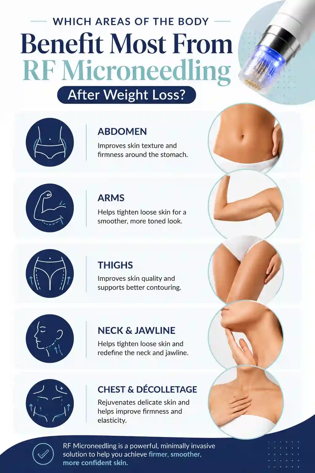 Which Areas of the Body Benefit Most From RF Microneedling After Weight Loss East Kilbride